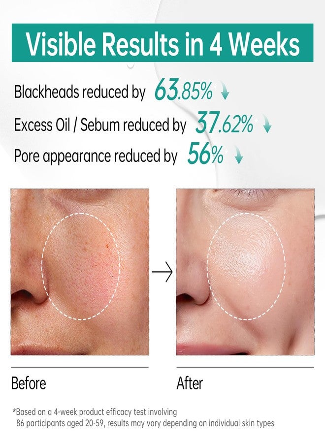 BOLI Azelaic Acid Serum for Face, Smoothing Balancing Essence with Saicylic Acid Niacinamide Retinol (1.01 fl oz) - Image 5